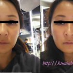 リファカラット口コミ評判 2年使用した効果をレポ 買ってはいけないは本当 スキンケア ライフ